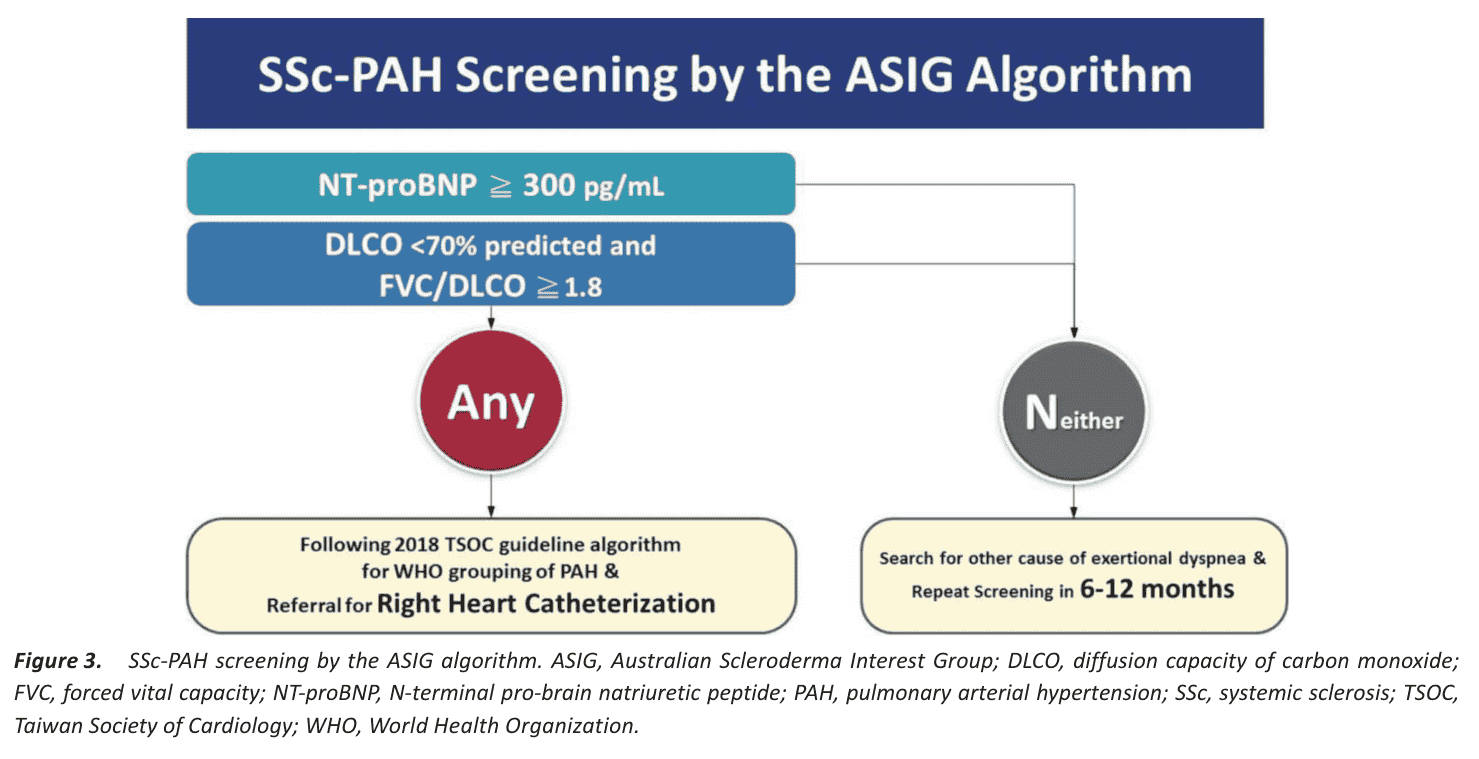 Figure 3 ASIG algorithm