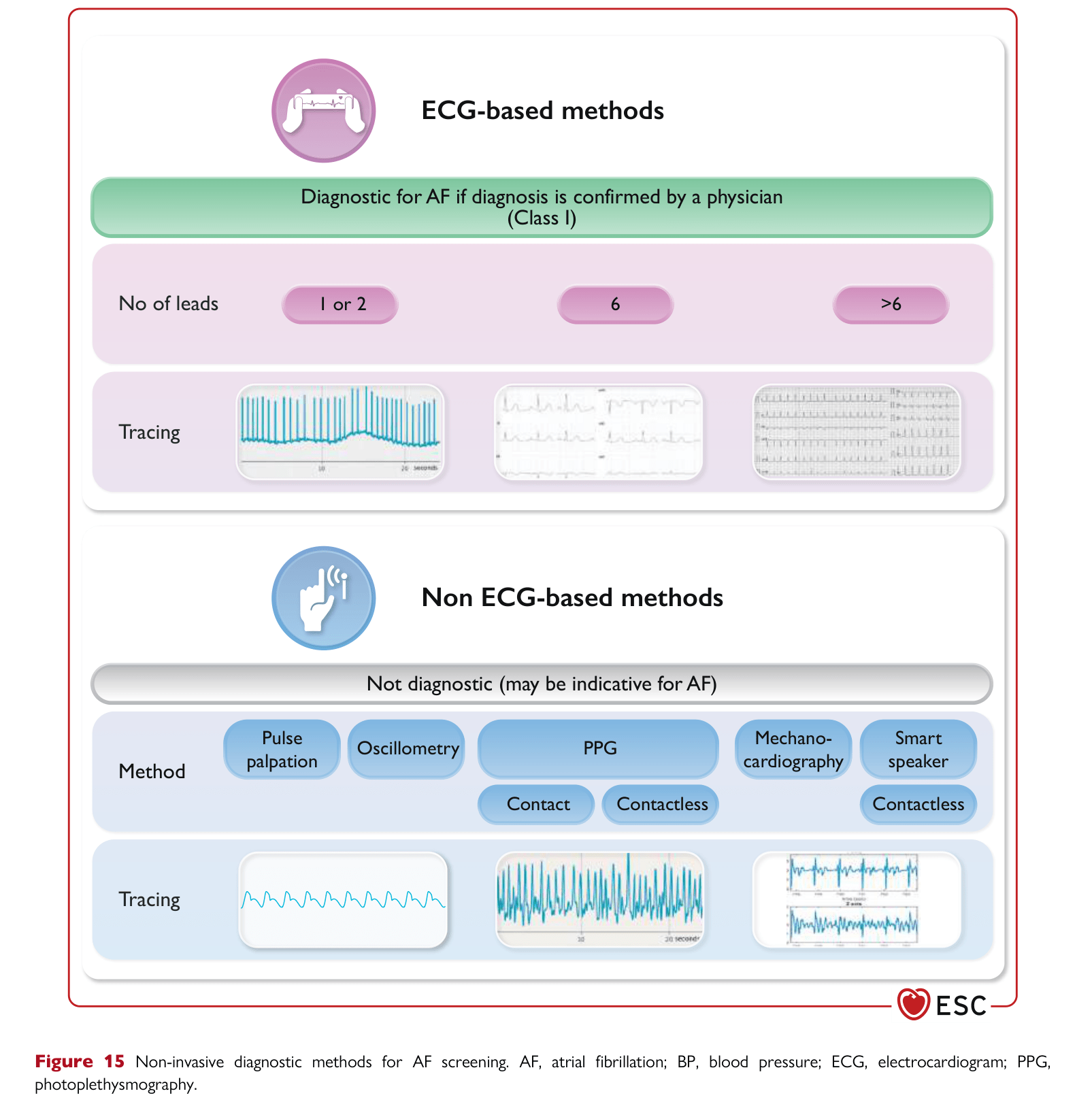 ESC 2024 AF — Figure 15 Non-invasive diagnostic methods for AF screening