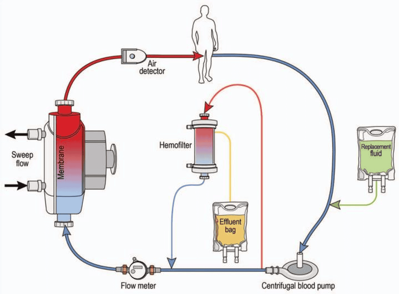 KDIGO 2026 AKI/AKD — Figure 18