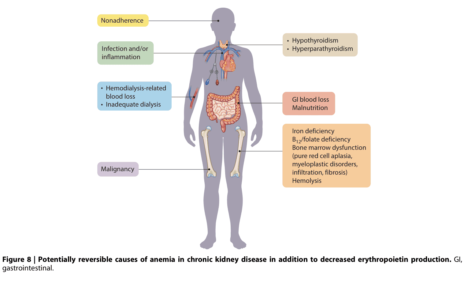 KDIGO anemia — Figure 8 可逆性貧血原因