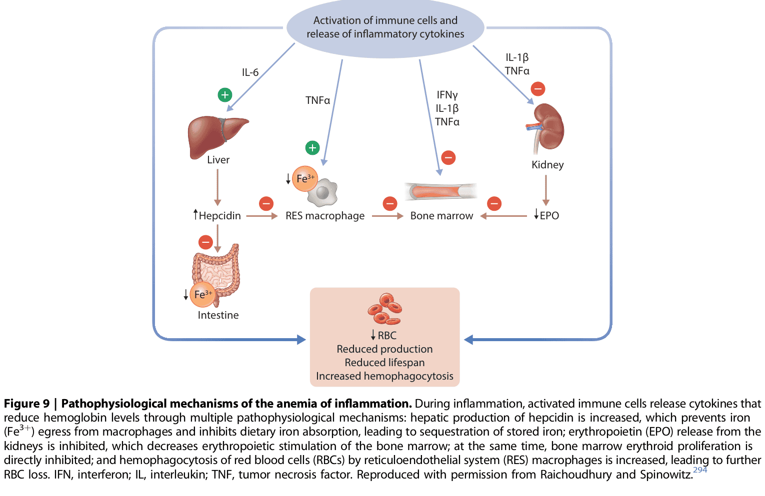 KDIGO anemia — Figure 9 發炎性貧血機轉
