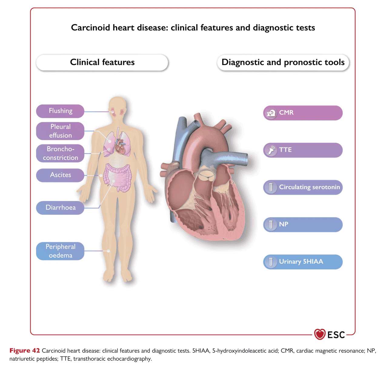 ESC cardioonc2022 — Figure 42