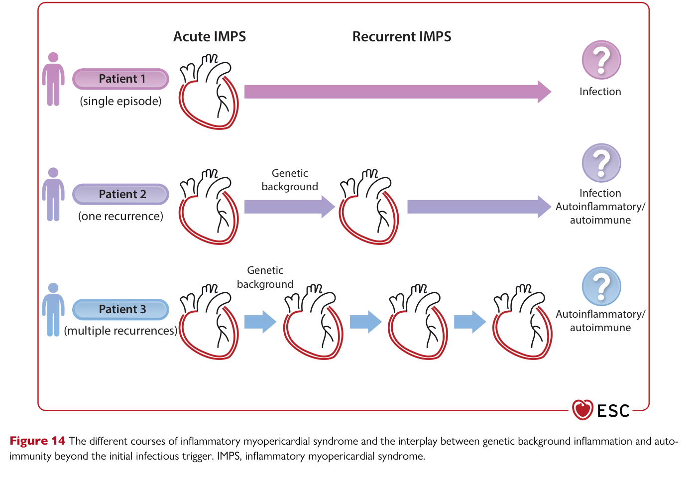 2025 ESC Myocarditis & Pericarditis — Figure 14
