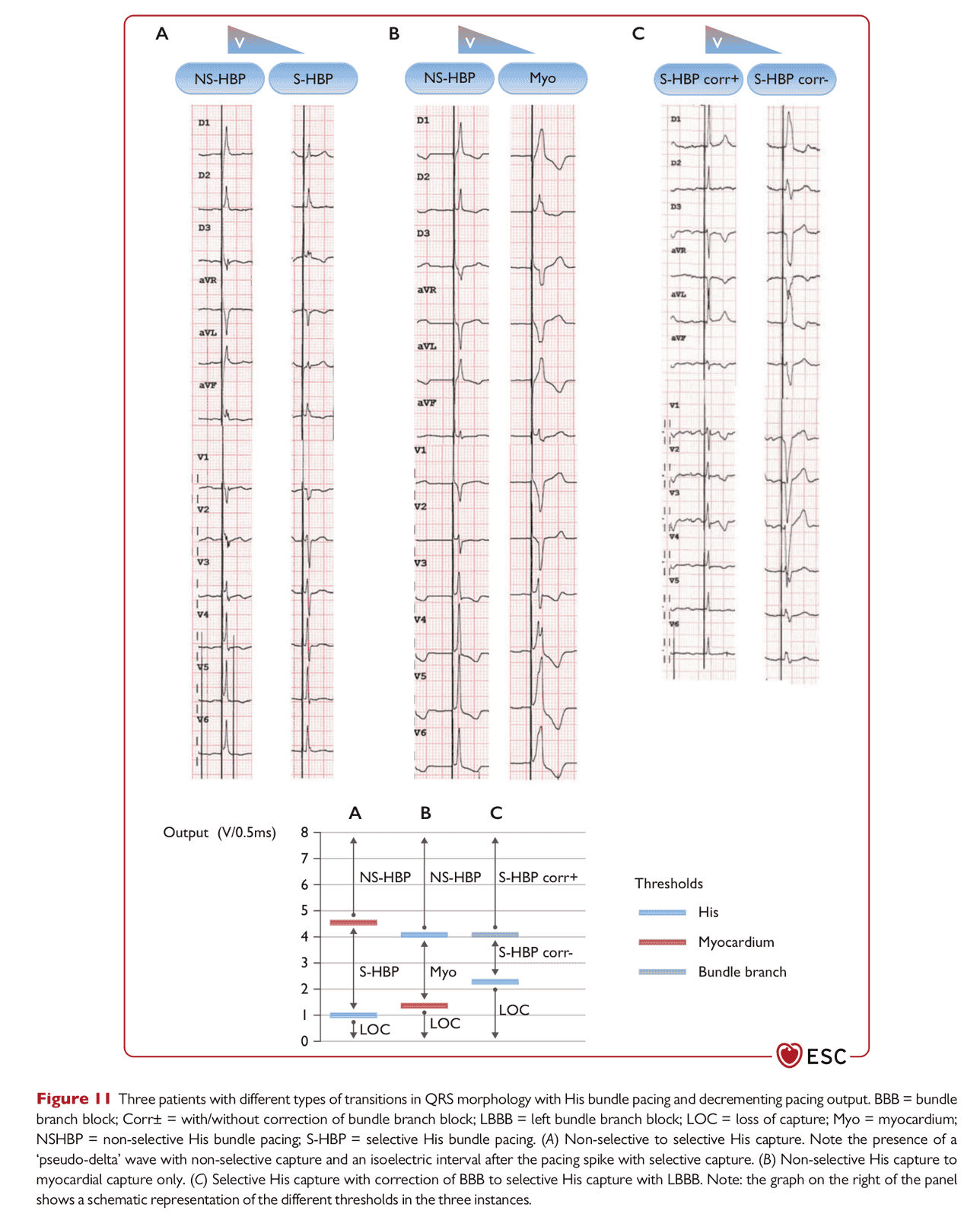 ESC pace2021 — Figure 11