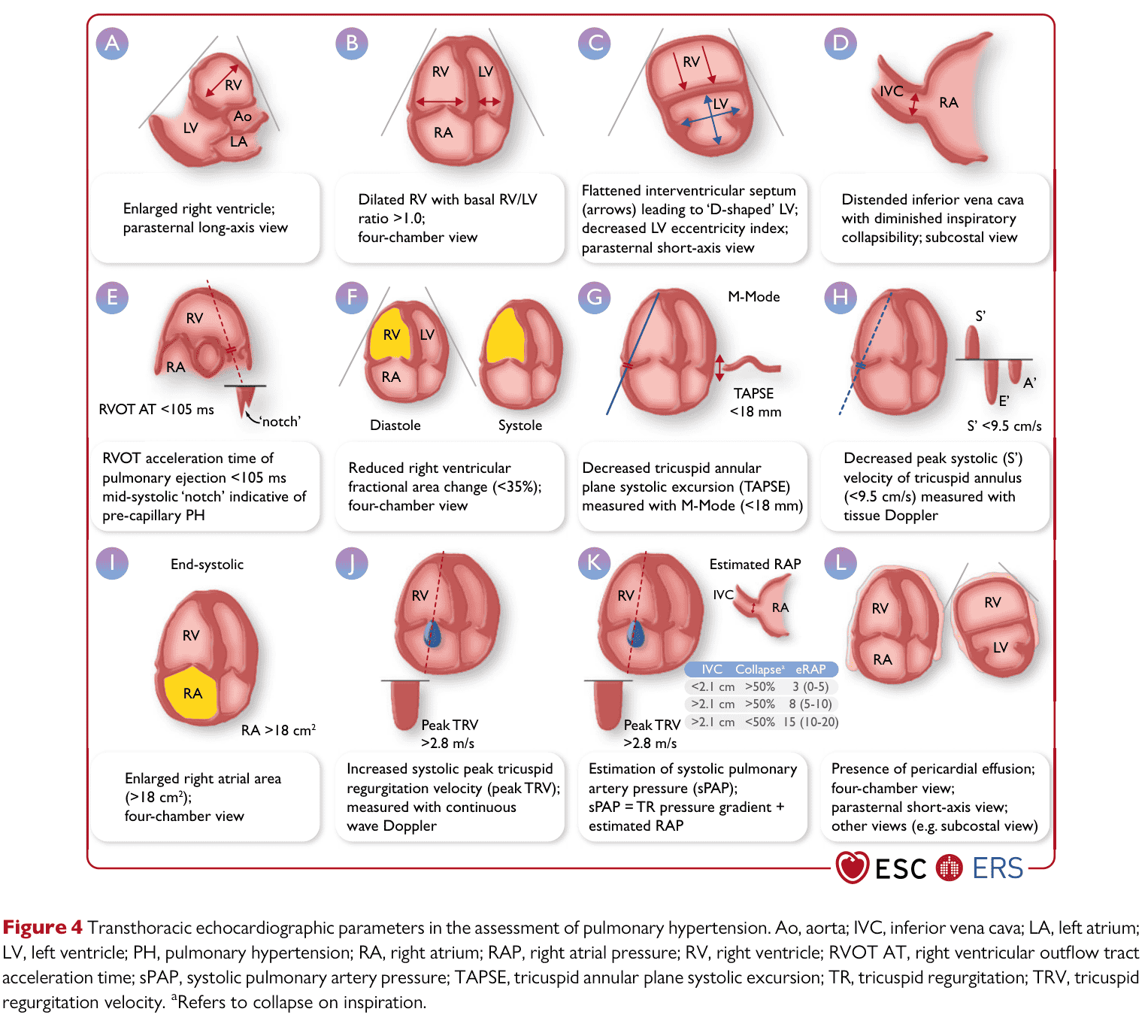 ESC PH 2022 — Figure 4 TTE parameters