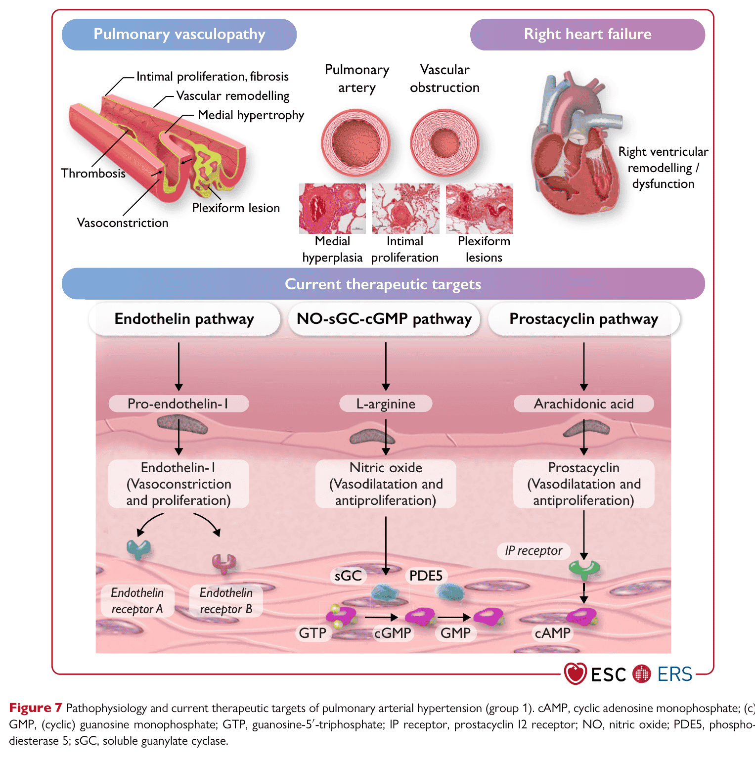 ESC PH 2022 — Figure 7 pathophysiology and therapeutic targets
