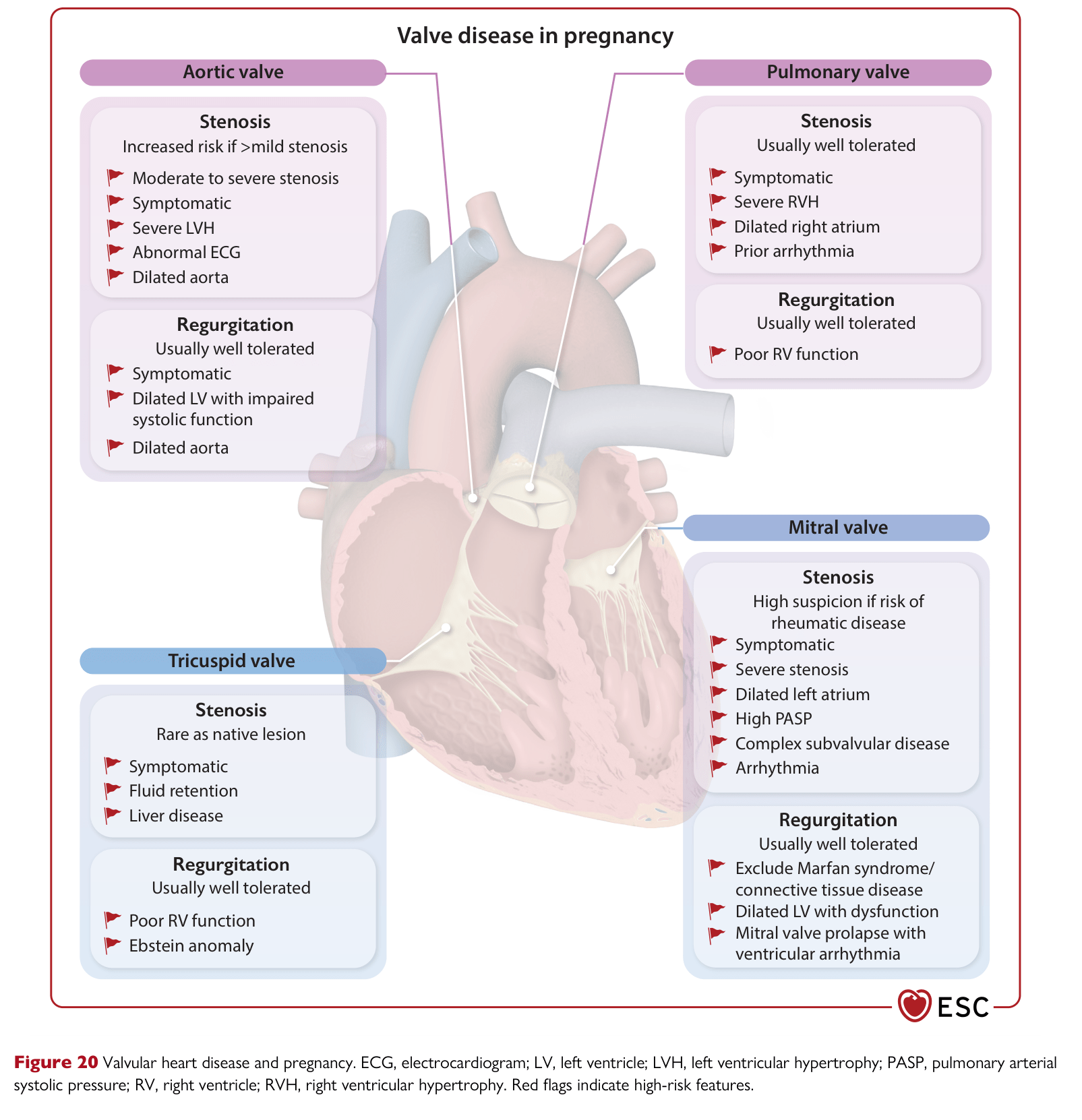 ESC 2025 Pregnancy — Figure 20 Valvular heart disease in pregnancy
