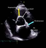 RVOT/PA 內徑