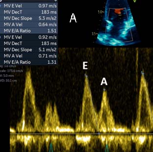 E/A Fig A