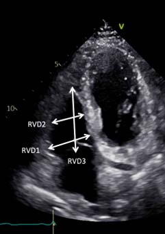 RV 尺寸 RVD1 RVD2 RVD3
