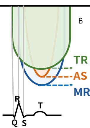 AV CW Fig B 勿誤 MR/TR