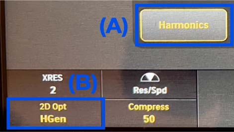 2D control 範例5