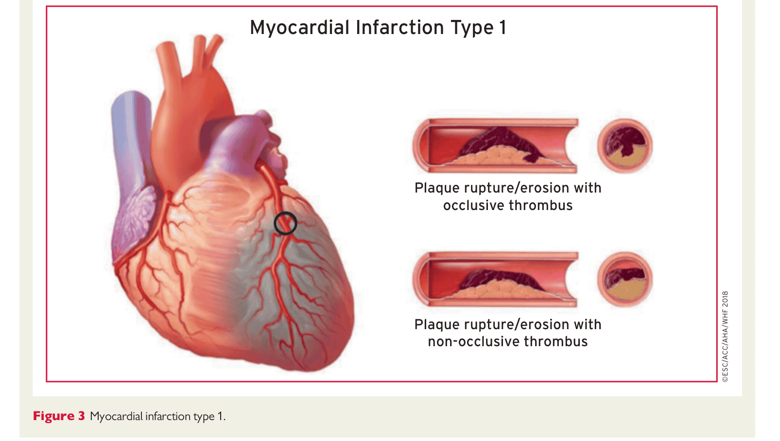 ESC 4th UDMI — Figure 3