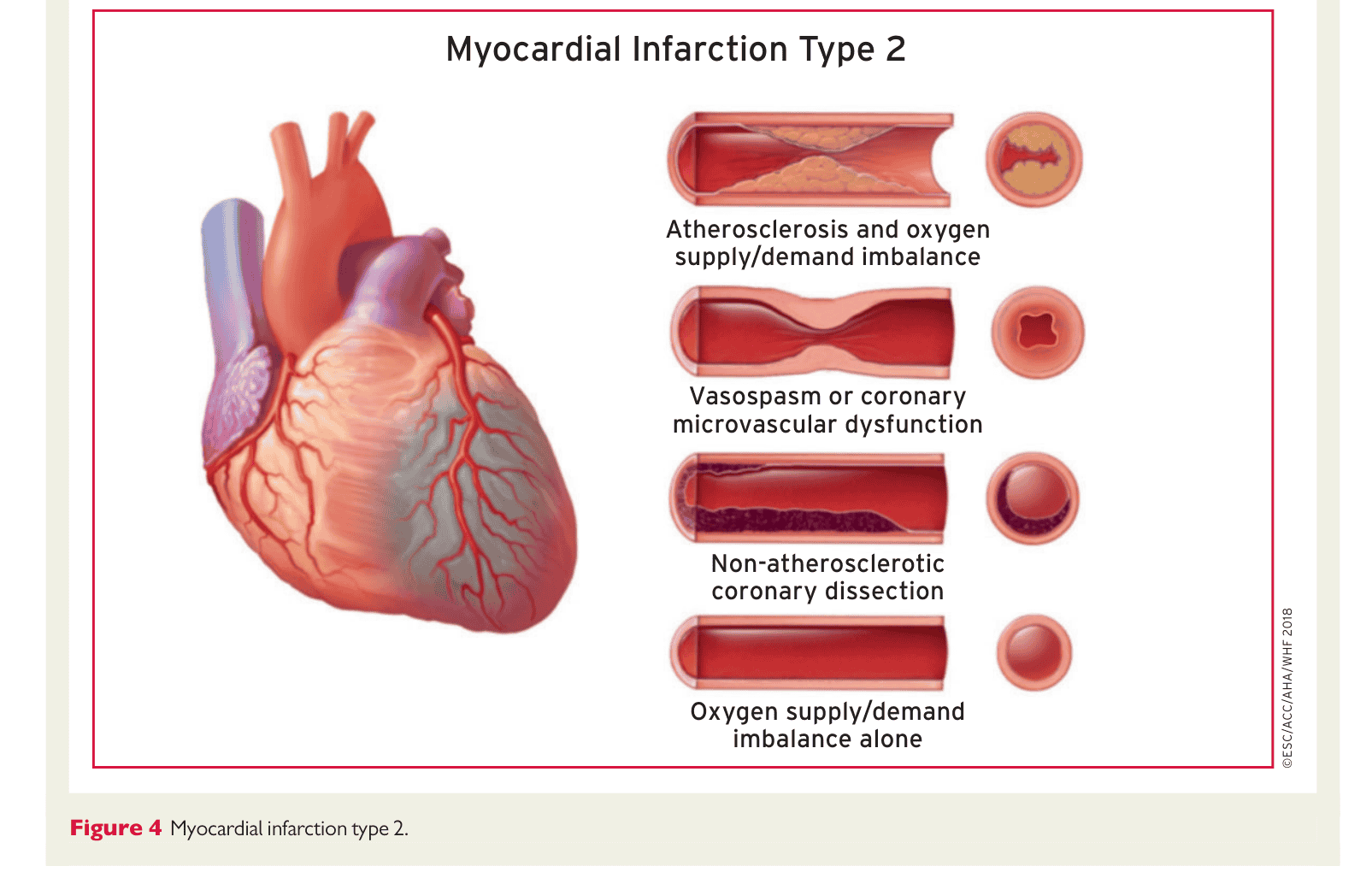 ESC 4th UDMI — Figure 4