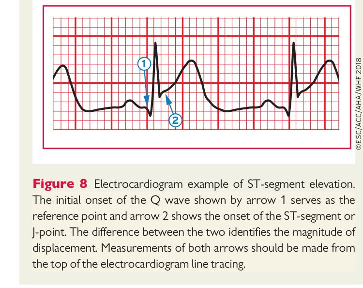 ESC 4th UDMI — Figure 8