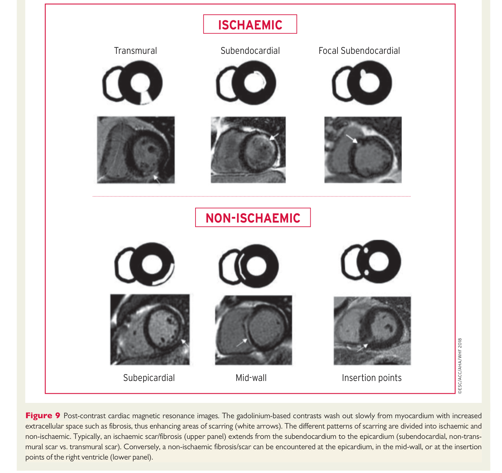 ESC 4th UDMI — Figure 9