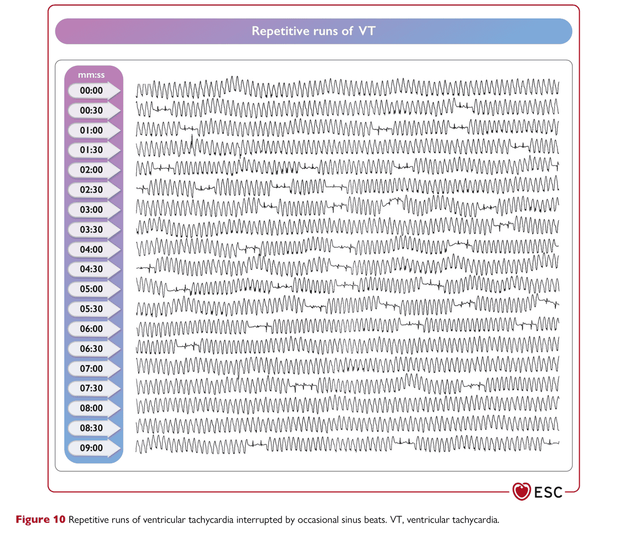 ESC va2022 — Figure 10 反覆 VT runs